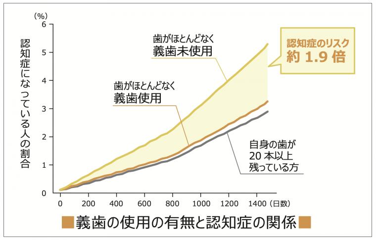 インプラントで認知症を予防できる？