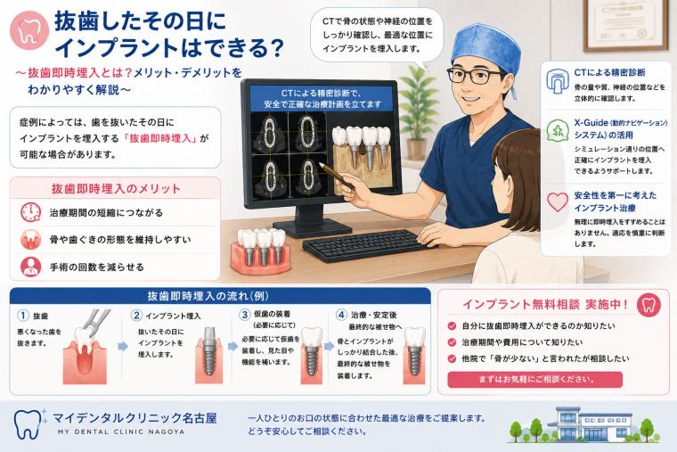 抜歯したその日にインプラントはできる？ ～抜歯即時埋入とは？メリット・デメリットをわかりやすく解説～